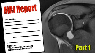 Shoulder PAIN  Understand your MRI Report [upl. by Notac]