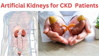 Artificial Kidneys A Promising Future for Chronic Kidney Disease Patients [upl. by Llyrpa]