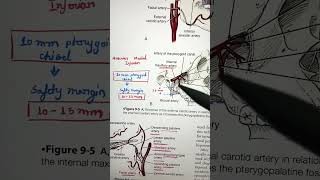 “Le Fort 1 Maxillary Osteotomy and the position of Maxillary Artery” neetmds mds bds anatomy [upl. by Archibald]