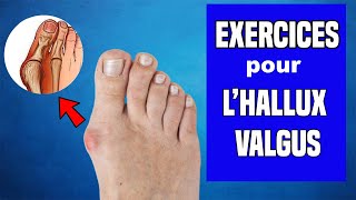 HALLUX VALGUS  TRAITEMENT ET EXERCICES KINÉ [upl. by Reggy]