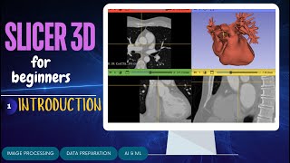 Introduction to Slicer 3D  Tutorial for Dicom data handling [upl. by Amberly]