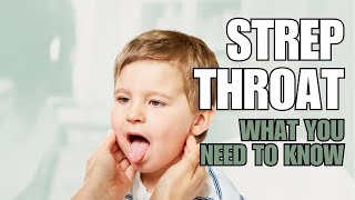 Doctor Tips  Strep Throat [upl. by Belcher]