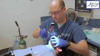 Jackson Rees Mapleson F circuit Nasal intubation in a dental office [upl. by Russon]