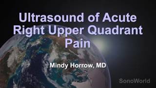 Ultrasound of Acute Right Upper Quadrant Pain [upl. by Ojeitak39]