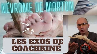 Névrome de MORTON mal au pied les solutions naturelles morton halluxvalgus podologie orteils [upl. by Torosian]