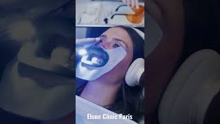 Blanchiment dentaire chez le dentiste  Tout ce que vous devez savoir en 15 secondes [upl. by Assilem151]