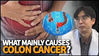 What mainly causes Colon Cancer What are the diagnosis symptoms and treatments [upl. by Nylirac273]