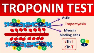 Troponin test and its significance [upl. by Mcspadden]