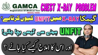 GAMCA CHEST XRAY Kesy clear Karain How To Remove Chest xray spots Saudia medical AIRLINE SEEKER [upl. by Vyky]