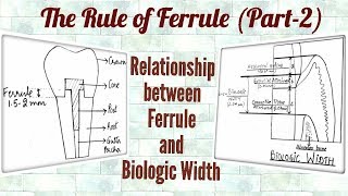 Ferrule Effect Part2 Relationship between Ferrule and Biologic Width [upl. by Conger211]