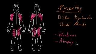 Syndrome Myopathy [upl. by Acissehc246]