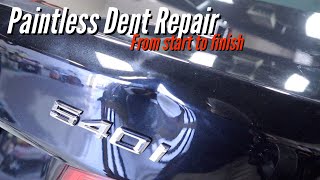 Bmw 540i Large Dent Repair  Dentless Touch  Washington DC [upl. by Eimarrej]