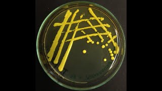 Micrococcus luteus  the most common cleanroom bacterium [upl. by Nekcerb]