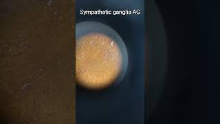 Sympathatic ganglia AG [upl. by Hagep]