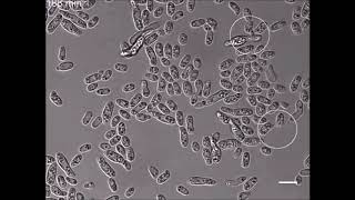 Livecell imaging of conidial anastomosis tube fusion during colony initiation in Fusarium oxysporum [upl. by Alidus]