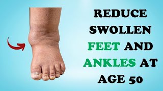 6 Effective Ways to Combat Swollen Feet and Ankles in Your 50s [upl. by Meedan]