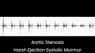 Aortic Stenosis Ejection Systolic Murmur [upl. by Nekcarb]