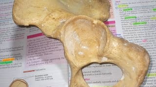 Acetabulum and Obturator foramen Human Anatomy [upl. by Risley]