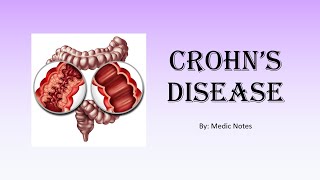 Crohns disease  vs ulcerative colitis extraintestinal manifestation investigation treatment [upl. by Bulley]