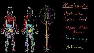 Syndrome Myelopathy [upl. by Rosemaria796]