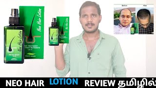 Neo hair lotion review in tamil trending hair lotion in tamil hair regrow lotion mr surya tamil [upl. by Arual]