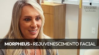 MORPHEUS  Procedimento de rejuvenescimento completo [upl. by Pelson]