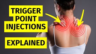 Myofascial Pain Trigger Point Injections Explained [upl. by Acemat654]