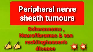 Peripheral nerve sheath tumours [upl. by Burr]