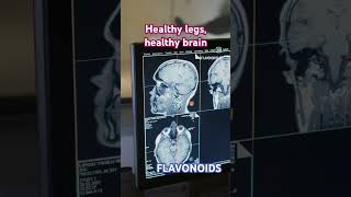 Healthy legs healthy brain blood circulation with Flavonoids legs brain [upl. by Ycrem]