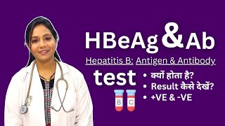 HBeAg and Antibodies Test in Hindi  Positive Negative Result Analysis [upl. by Peirsen72]