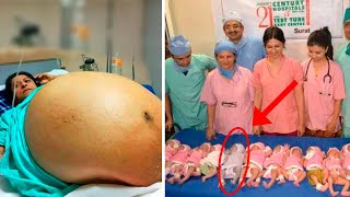 Mother Gives Birth to 10 Babies and Doctors Realize One of Them Isnt a Baby Biggest Shock [upl. by Dougy]