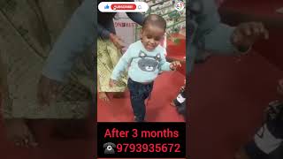 cerebralpalsytreatment physiotherapy childphysiotherapy gorakhpur physiodrshivomsingh cpchild [upl. by Sholes]