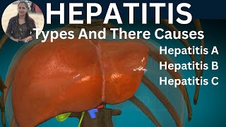 HEPATITISTypes and CausesTreatment of HepatitisAbhilasha Dubey [upl. by Kerianne]