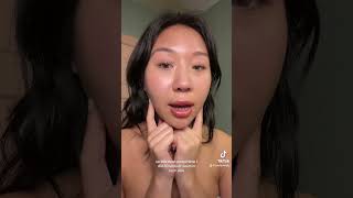 Botox in my masseter muscle to slim my face [upl. by Duj532]