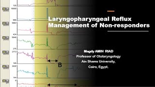 Laryngopharyngeal Reflux Management of Non responders [upl. by Keane692]