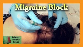 Migraine Cure Nerve Block  Auburn Medical Group [upl. by Esilec]