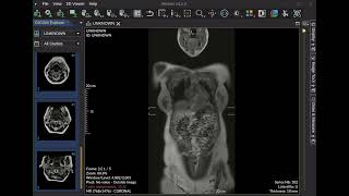 Merge split subseries of enhanced DICOM objects [upl. by Jb]