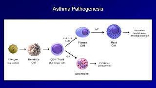 Asthma and COPD  Pathogenesis and Pathophysiology [upl. by Senn705]