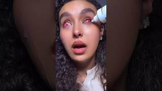 Part 2 😱 trying to remove sclera lenses 🧟‍♀️ nouhailaait [upl. by Zerat]