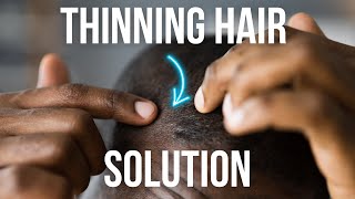 3 Natural Ways to Combat Hair Loss  Jojoba Oil Jamaican Black Castor Oil and Rosemary Oil [upl. by Jemma]