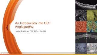 Introduction to OCT Angiography [upl. by Ynner]