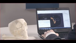 MIMICS INNOVATION SUITE 21  Benefits for Orthopedic and Craniomaxillofacial Applications [upl. by Ennayehc777]