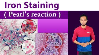 Iron Staining Clear Explain  Pearls stain  Prussian blue reaction [upl. by Ragland]