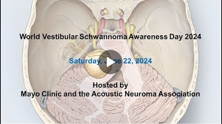 Vestibular schwannoma Molecularlyinformed therapies [upl. by Urbain941]