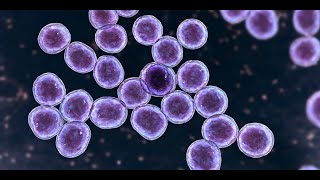 Nasal Carriage of Staphylococcus and MRSA with Their Mupirocin Susceptibility among Students [upl. by Eliseo970]