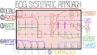 ECG Interpretation Made Easy Learn How to Interpret an ECG in 13 Minutes [upl. by Junina917]