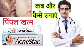 Acnestar gel HONEST review in hindi  Acnestar gel results benefits uses price info [upl. by Ahsikram]