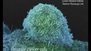 Electron microscopy of cancer cells from Cancer Research UKfunded scientists [upl. by Pitzer]