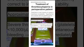 Treatment of thrombocytopenia in perioperative patient [upl. by Tracey570]