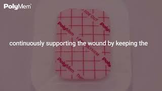 Wound Healing Journey with PolyMem Dressings  Part 2 Proliferative Phase [upl. by Bringhurst633]